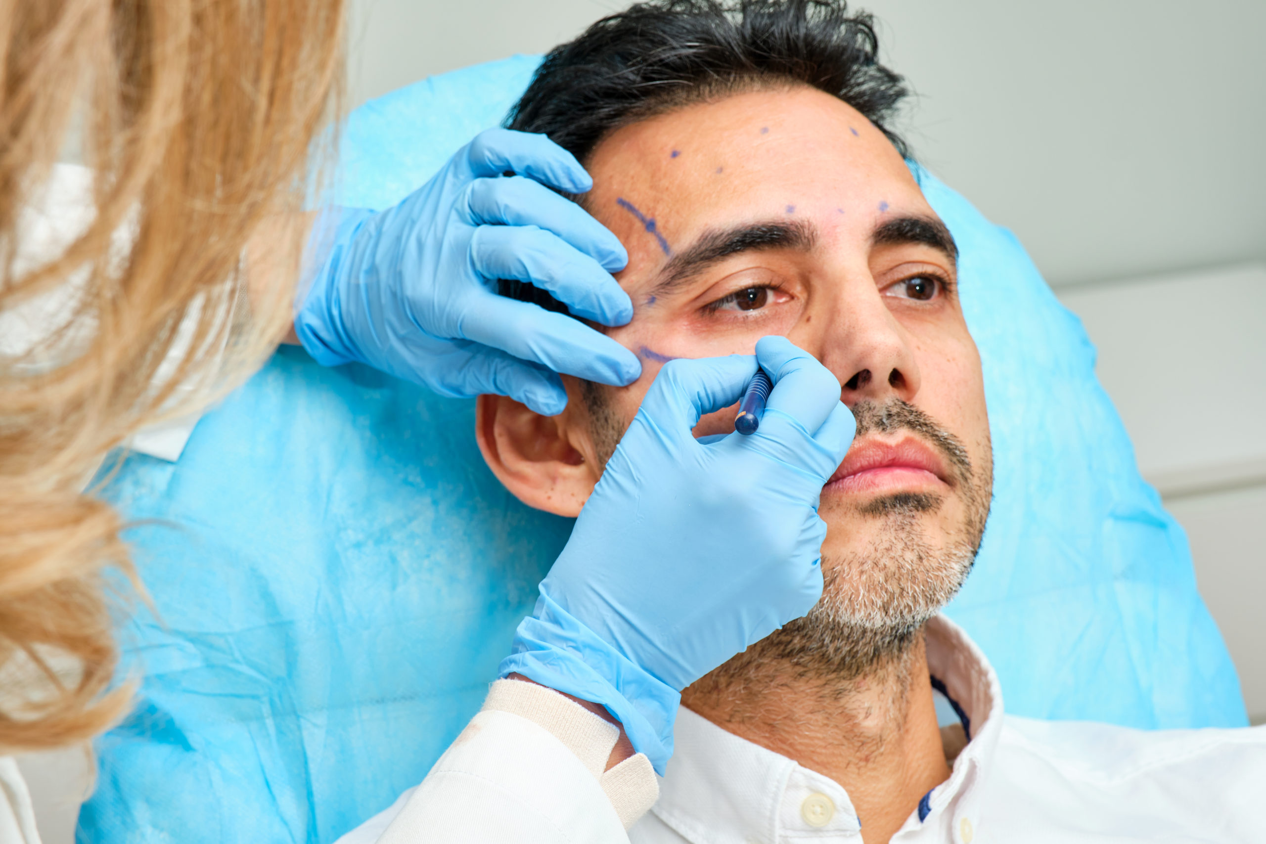 Beneficios de una blefaroplastia láser